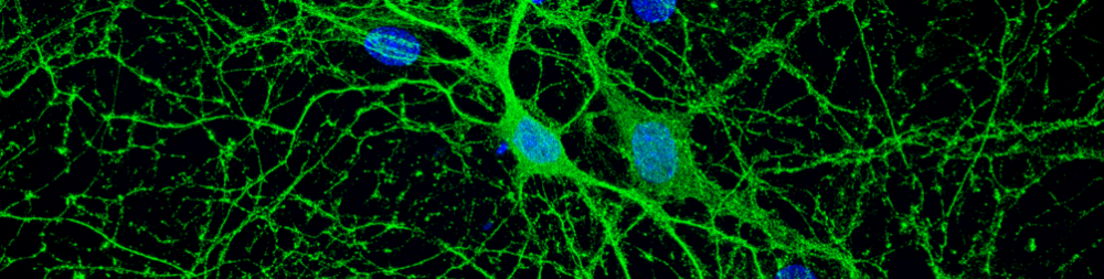 Cell Culture Flask with Stem Cells