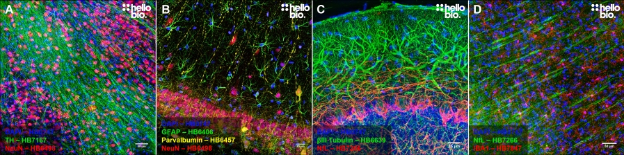 IHC Example Images