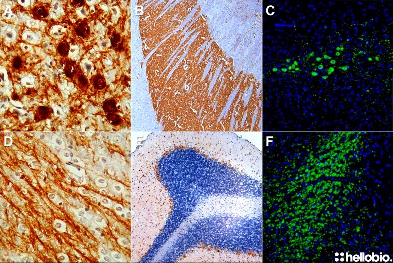 Representative results using the Hello Bio IHC-P protocol