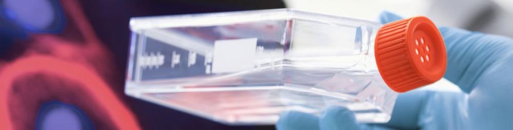 Cell Culture Flask with Stem Cells