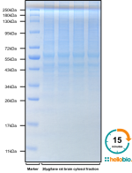 Figure 1. Visualize proteins in as little as 15 minutes with SuperBlot<sup>TM</sup> Rapid Coomassie Staining Solution