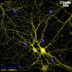 Figure 1. VLP1 expressing cultured rat hippocampal neurons stained by HB9013.
