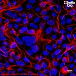 Figure 1. Vimentin expression in HEK293T cells visualised using HB6497 and HB7393 Goat Anti-Mouse H&L (Janelia Fluor® 646).