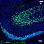 Figure 1. Janelia Fluor 549 conjugated anti-NeuN antibody staining in rat hippocampus