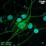 Neurofilament L expression in a cultured rat neuron visualised using HB7266