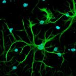 Anti-GFAP antibody ValidAb<sup>TM</sup>