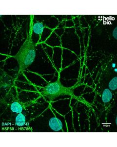 Figure 1. HSP60 staining with HB7863 reveals the dense mitochondria in cultured rat neurones.