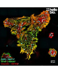Figure 4. Vimentin and GFAP expression in a rat cultured neuron preparation visualised using HB7843 and HB8267