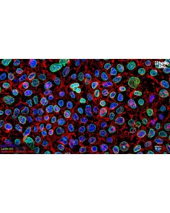 Figure 1. Lamin A/C staining in HEK293T cells. Mounted using MightyMount<sup>TM</sup> Antifade Fluorescence Mounting Medium with Phalloidin-TRITC (hardset).