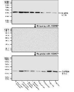 Figure 1. Stripping and re-probing of PVDF membrane using HB9167