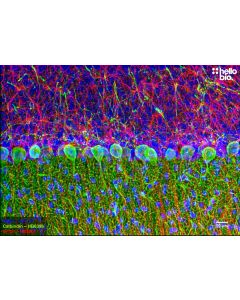 Figure 1. Calbindin and GFAP staining in the cerebellum. Mounted using MightyMount<sup>TM</sup> Antifade Fluorescence Mounting Medium with DAPI (hardset)