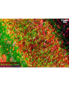Figure 1. MBP and TH staining in rat cerebellum. Mounted using MightyMount<sup>TM</sup> Antifade Fluorescence Mounting Medium with propidium iodide (hardset).