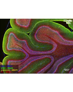 Figure 1. GFAP, alpha-synuclein and Neurofilament light staining in rat cerebellum. Mounted using MightyMount<sup>TM</sup> Antifade Fluorescence Mounting Medium (hardset).