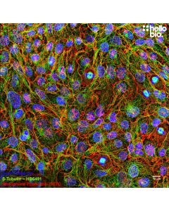 Figure 1. β-tubulin staining in HEK293T cells. Mounted using MightyMount<sup>TM</sup> Antifade Fluorescence Mounting Medium with Phalloidin-TRITC (aqueous).