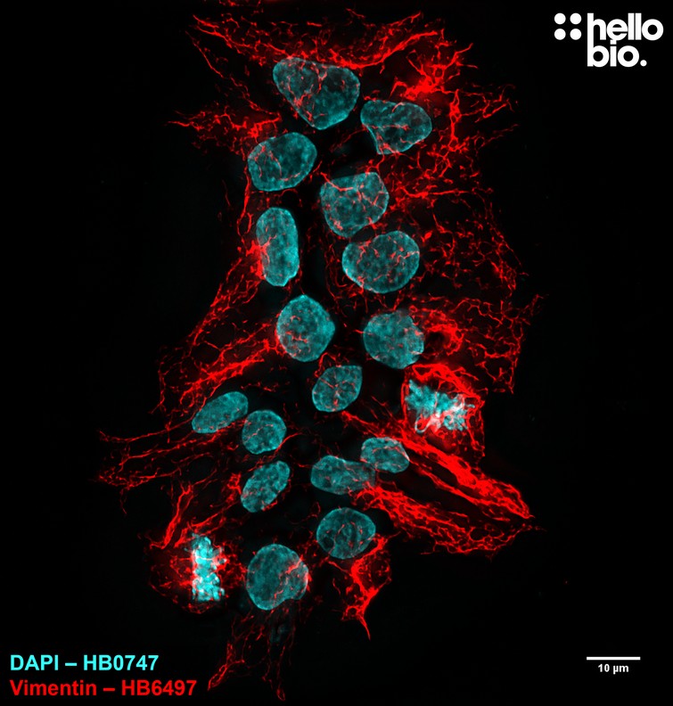 Figure 4. Vimentin staining in HEK293T cells using HB8144 Goat Anti-Mouse IgG H&L (Janelia Fluor&reg; 525) preadsorbed secondary antibody.