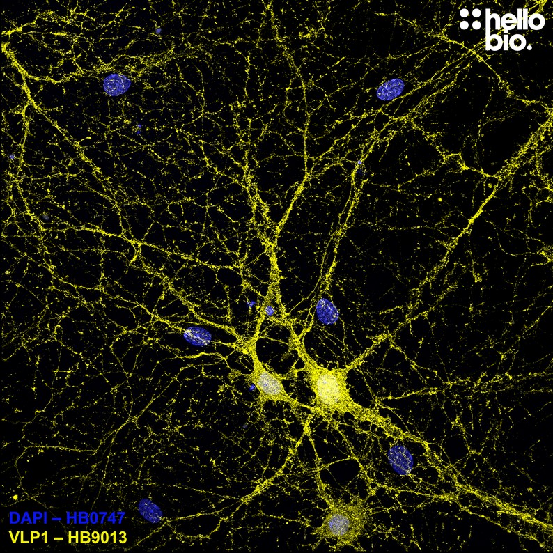 Figure 1. VLP1 expressing cultured rat hippocampal neurons stained by HB9013.