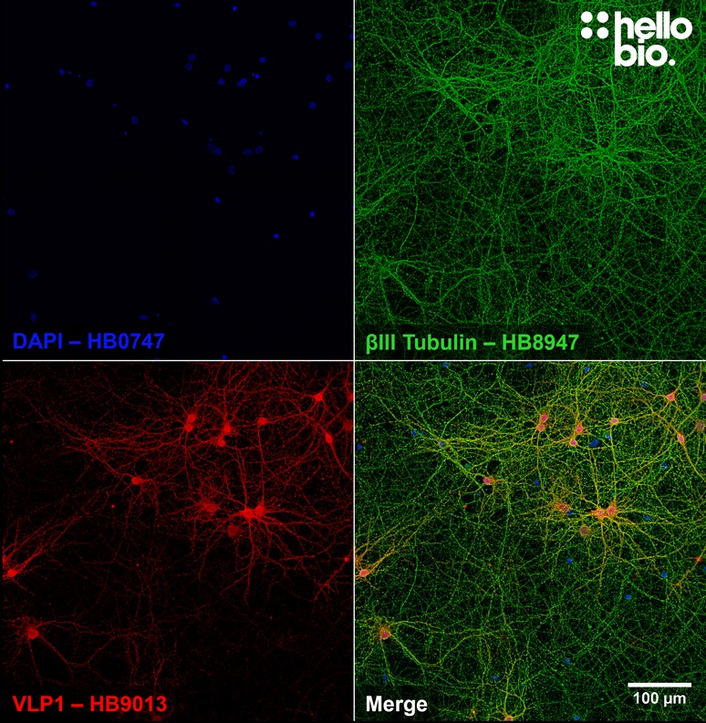 Figure 3. βIII Tubulin and VLP1 staining patterns in cultured rat hippocampal neurons.