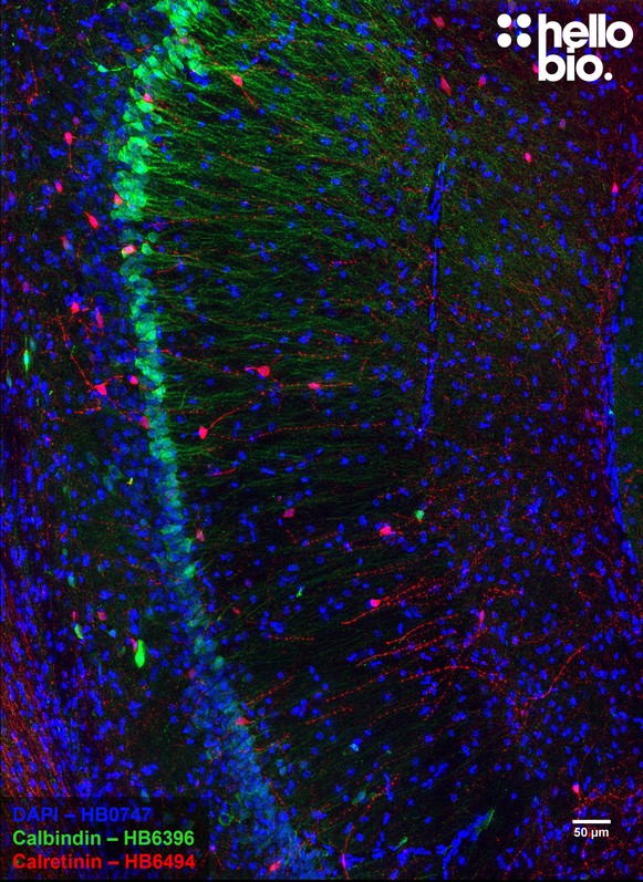 Figure 2. Calretinin and Calbindin expression in rat hippocampus CA1