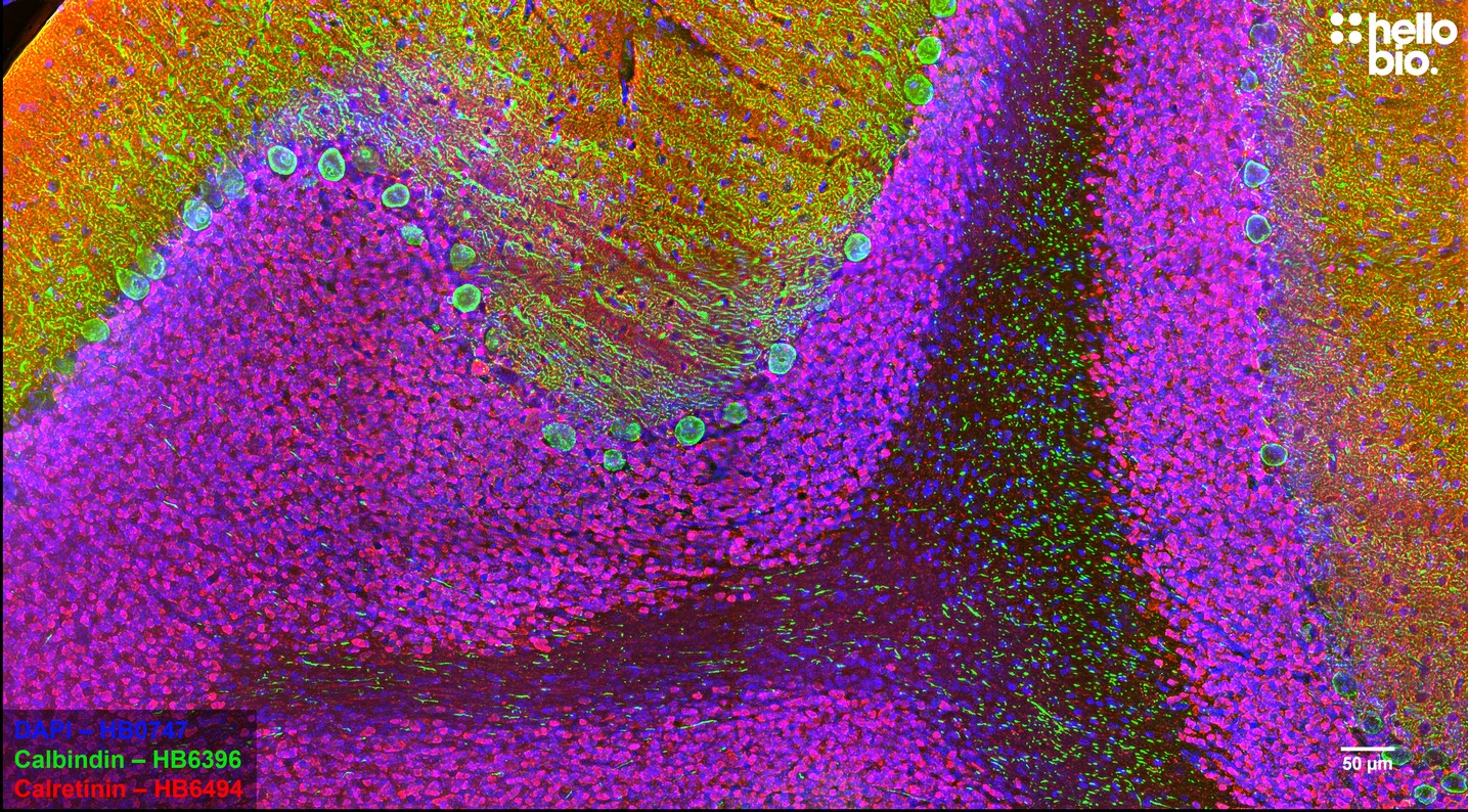 Figure 5. Calbindin and Calretinin positive neurons in rat cerebellum