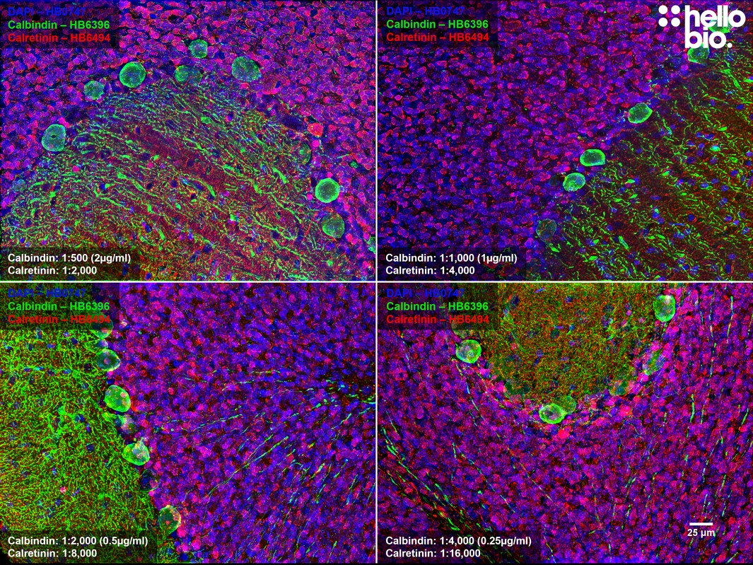 Figure 6. Concentration response of HB6396 and HB6494 in rat cerebellum.