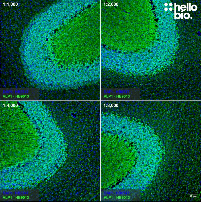 Figure 5. Concentration response of HB9013 staining in rat cerebellum.