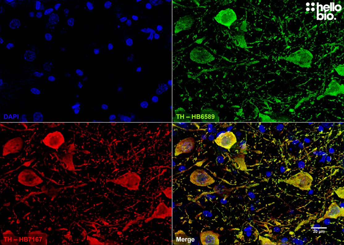 Figure 5. Independent antibody validation of HB7167 and HB6589 in dopaminergic midbrain neurons.