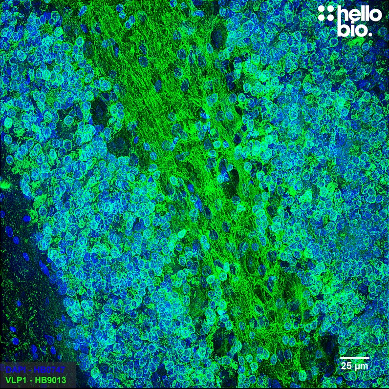 Figure 2. VLP1 positive staining in PFA fixed rat cerebellum sections