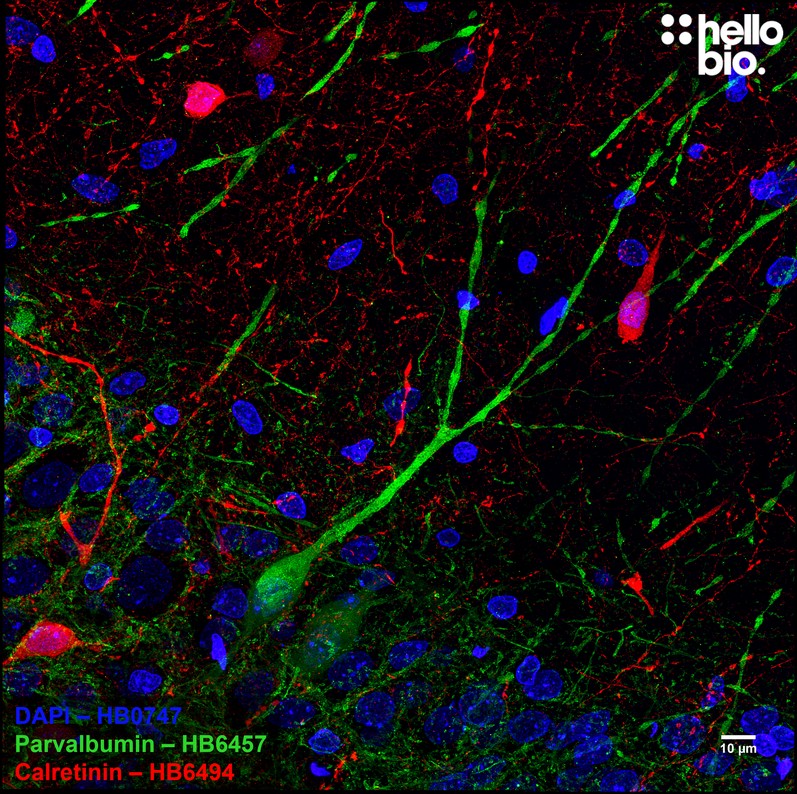 Figure 4. Parvalbumin and Calretinin expressing interneurons in hippocampal CA1.