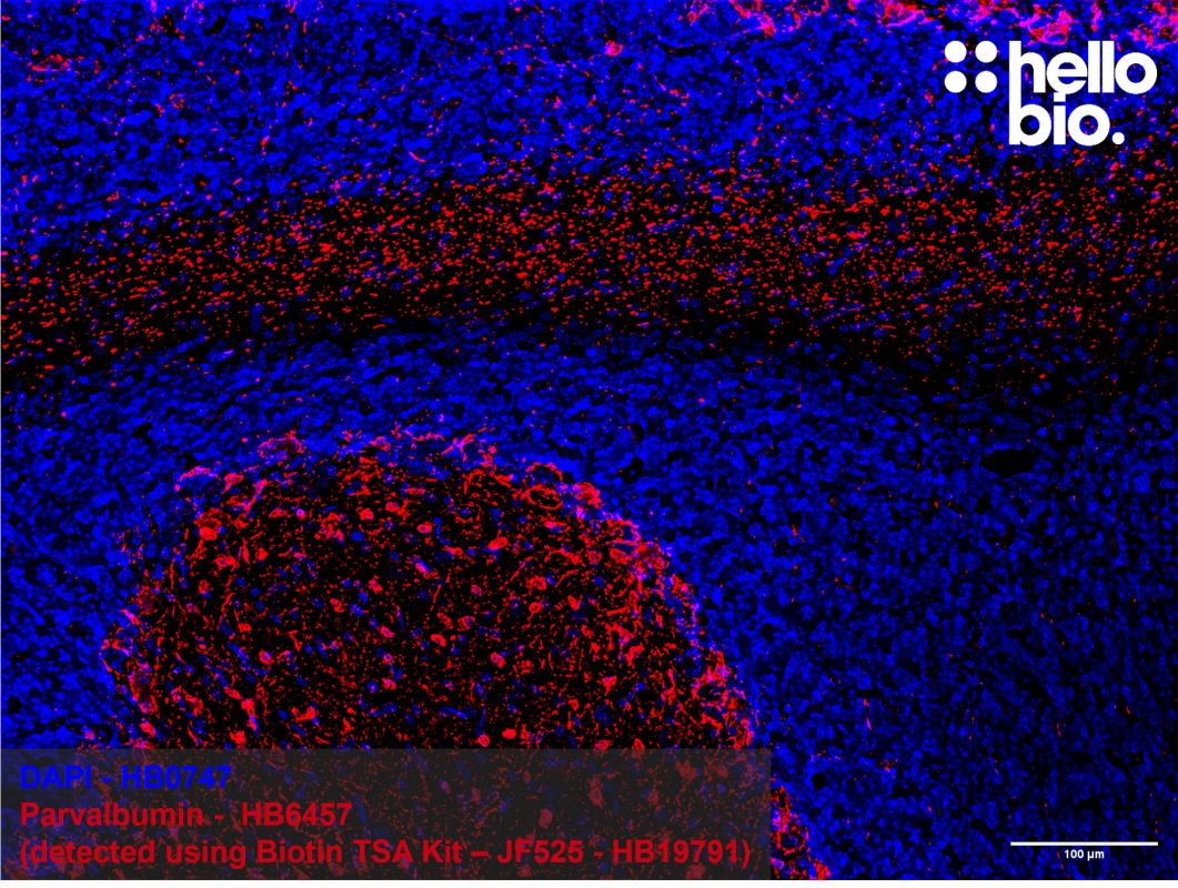 Figure 2: Parvalbumin expression in the rat cerebellum using tyramide signal amplification.