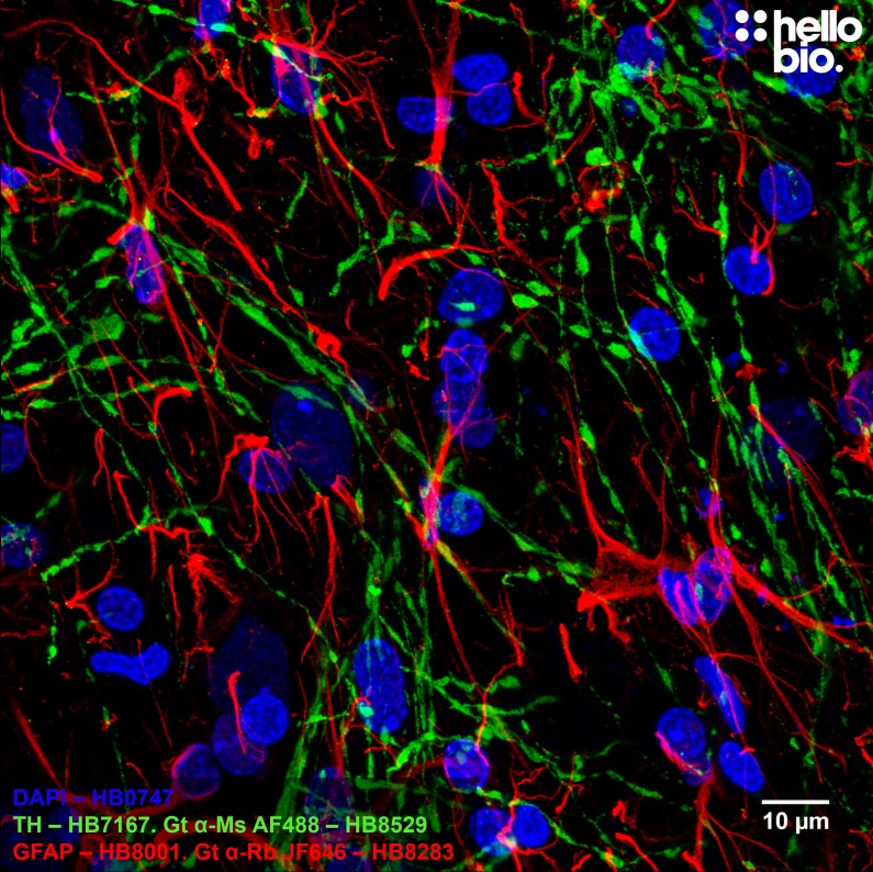 Figure 8. Tyrosine hydroxlase and GFAP staining in rat midbrain using HB8529 Goat Anti-Mouse H&L (AF488) and HB8283 Goat Anti-Rabbit H&L (Janelia Fluor&reg; 646) 