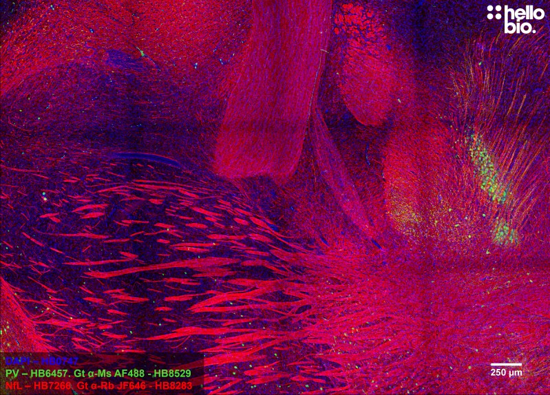 Figure 1. Neurofilament L and Parvalbumin staining in rat midbrain using HB8283 Goat Anti-Rabbit H&L (Janelia Fluor&reg; 646) and HB8529 Goat Anti-Mouse H&L (AF488)