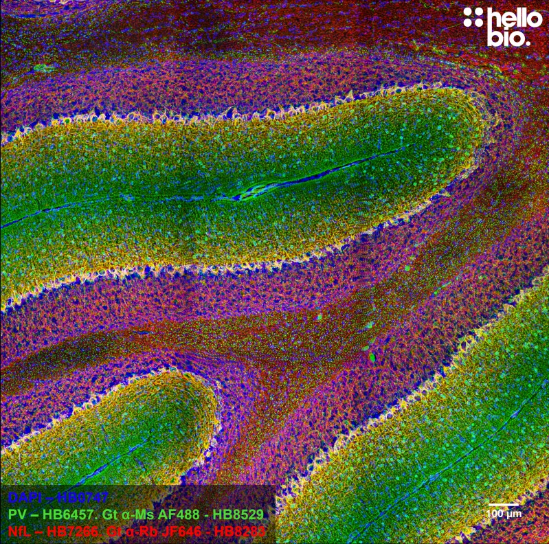 Figure 3. Parvalbumin and Neurofilament L and staining in rat cerebellum using HB8529 Goat Anti-Mouse H&L (AF488) and HB8283 Goat Anti-Rabbit H&L (Janelia Fluor&reg; 646)