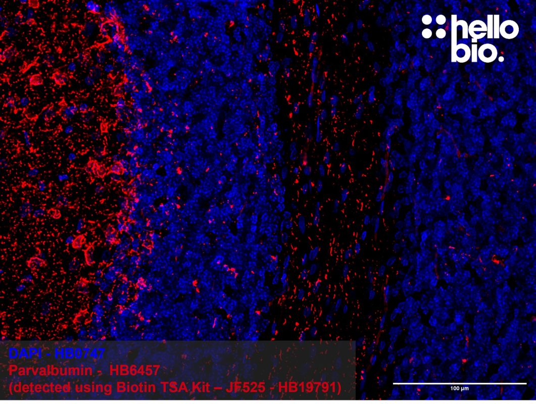 Figure 4: Tyramide signal amplification of parvalbumin positive interneurons in the rat cerebellum. 