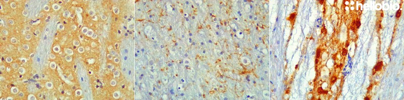 Figure 5. Tyrosine hydroxylase staining in rat brain visualized using biotin-streptavidin detection.