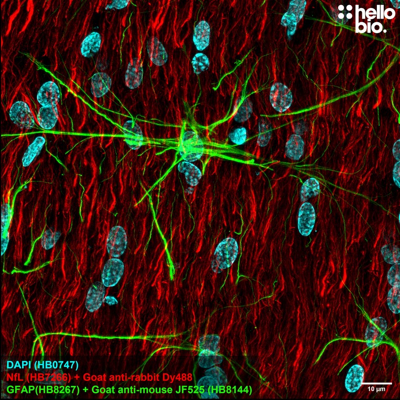 Figure 2. GFAP staining using HB8144 Goat Anti-Mouse IgG H&L (Janelia Fluor&reg; 525) preadsorbed secondary antibody.