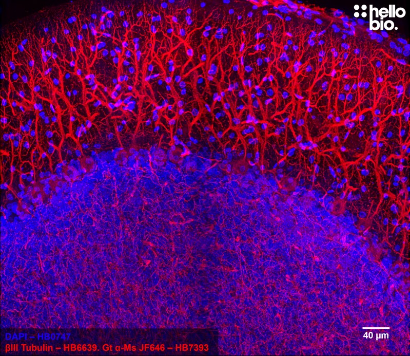 Figure 2. Purkinje neurons stained for βIII tubulin in rat cerebellum using HB6639 and HB7393 Goat Anti-Mouse H&L (Janelia Fluor® 646).