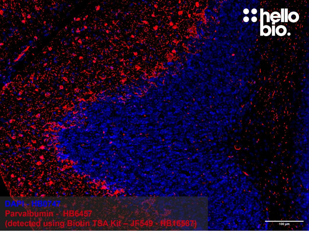 Figure 3: Tyramide signal amplification of parvalbumin positive interneurons in the rat cerebellum. 