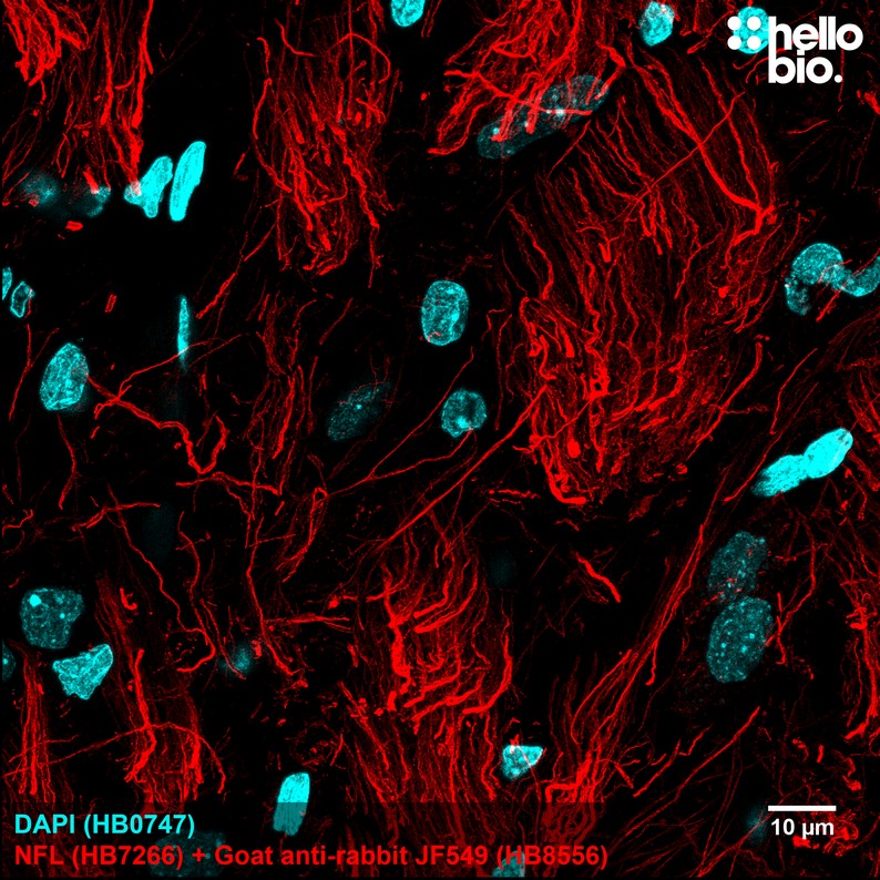 Figure 1. Neurofilament L staining in rat brain using HB8556 Goat Anti-Rabbit IgG H&L (Janelia Fluor&reg; 549) preadsorbed secondary antibody.