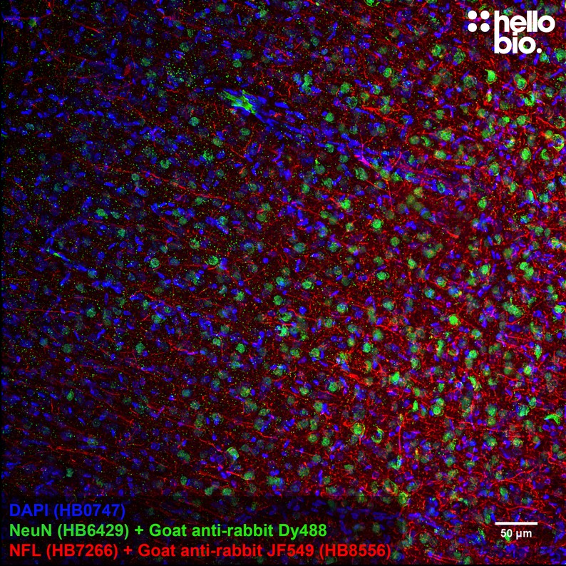 Figure 5. Neurofilament L staining in rat cortex using HB8556 Goat Anti-Rabbit IgG H&L (Janelia Fluor&reg; 549) preadsorbed secondary antibody.