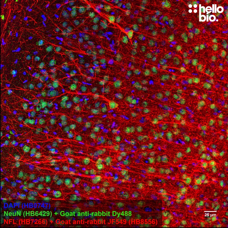 Figure 3. Neurofilament L staining in rat cortex using HB8556 Goat Anti-Rabbit IgG H&L (Janelia Fluor&reg; 549) preadsorbed secondary antibody.
