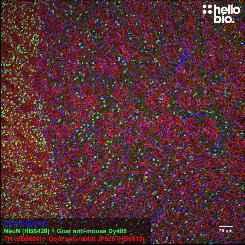 Figure 1. Tyrosine hydroxylase staining in rat striatum using HB6813 Goat Anti-Rabbit IgG H&L (Janelia Fluor&reg; 525) preadsorbed secondary antibody.