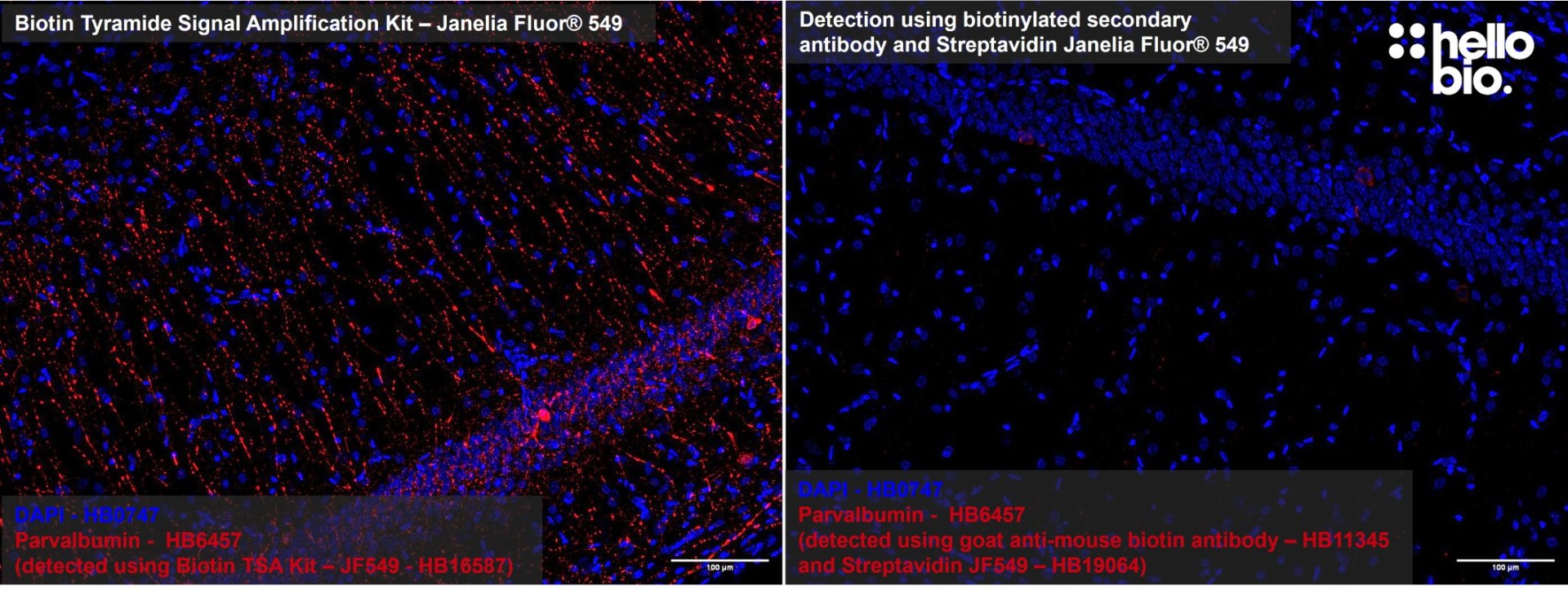 Figure 2: Tyramide Signal Amplification  compared to detection using secondary biotin antibody and streptavidin
