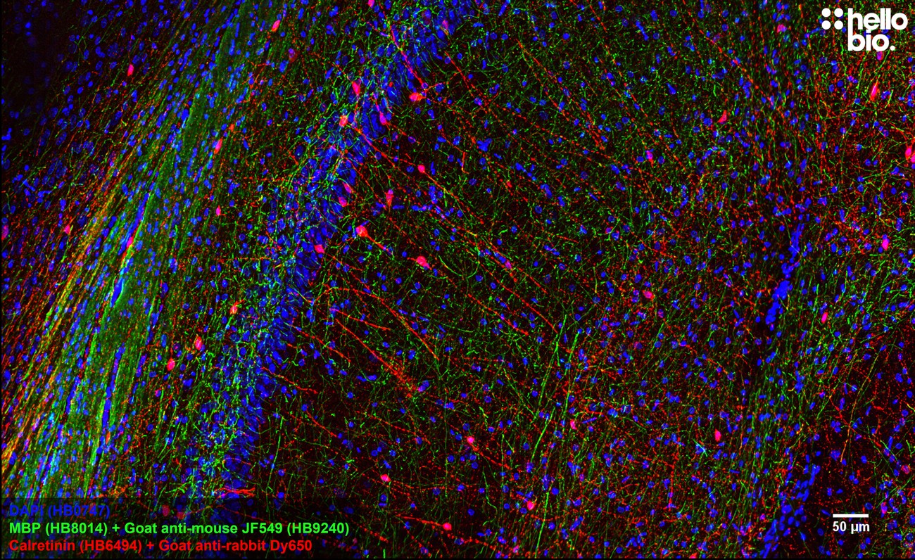 Figure 3. MBP staining using HB9240 Goat Anti-Mouse IgG H&L (Janelia Fluor&reg; 549) preadsorbed secondary antibody.