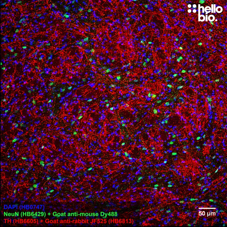 Figure 2. Tyrosine hydroxylase staining in rat striatum using HB6813 Goat Anti-Rabbit IgG H&L (Janelia Fluor&reg; 525) preadsorbed secondary antibody.