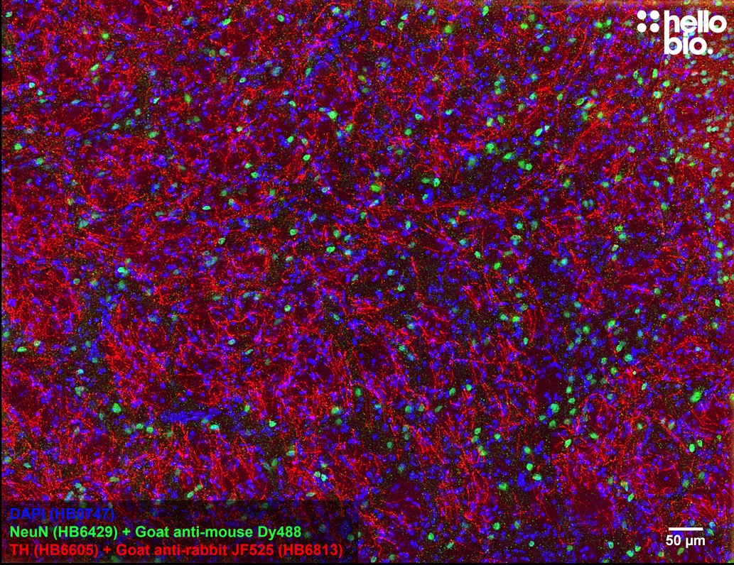 Figure 3. Tyrosine hydroxylase staining in rat striatum using HB6813 Goat Anti-Rabbit IgG H&L (Janelia Fluor&reg; 525) preadsorbed secondary antibody.