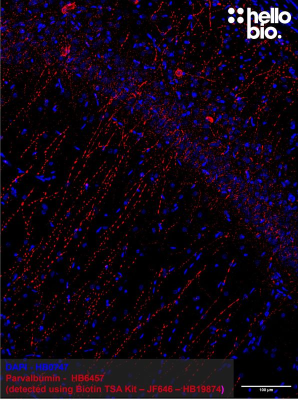 Figure 4: Tyramide signal amplification of parvalbumin positive interneurons in the rat hippocampus. 