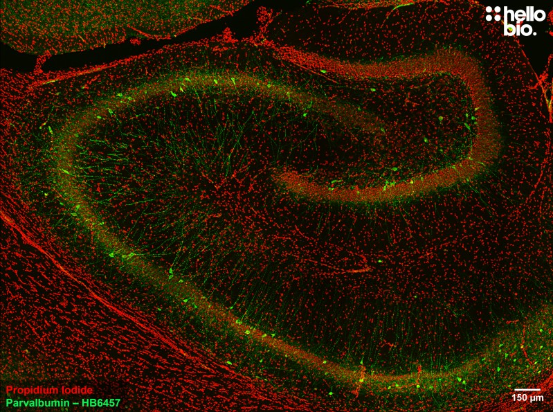 Figure 2. Parvalbumin staining in rat hippocampus. Mounted using MightyMount<sup>TM</sup> Antifade Fluorescence Mounting Medium with Propidium Iodide (aqueous).