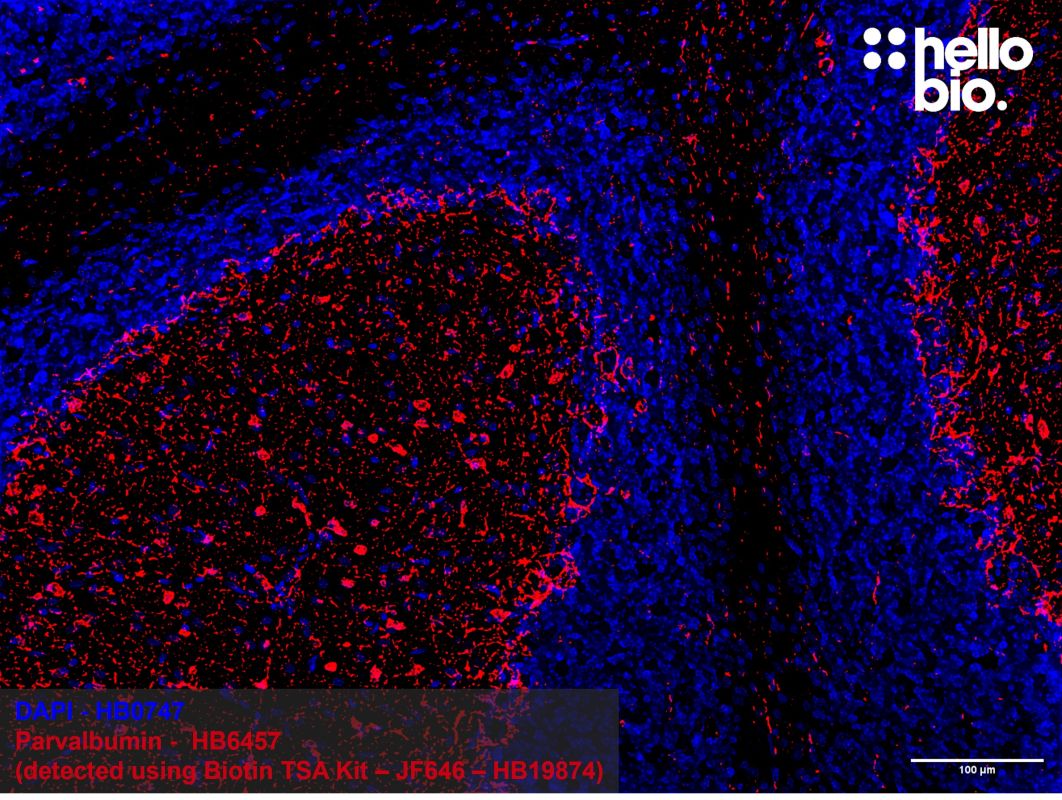 Figure 3: Tyramide signal amplification of parvalbumin positive interneurons in the rat cerebellum. 