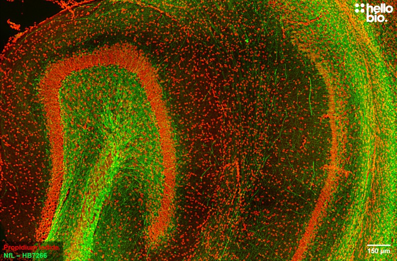 Figure 3. Neurofilament L staining in rat hippocampus. Mounted using MightyMount<sup>TM</sup> Antifade Fluorescence Mounting Medium with Propidium Iodide (aqueous).