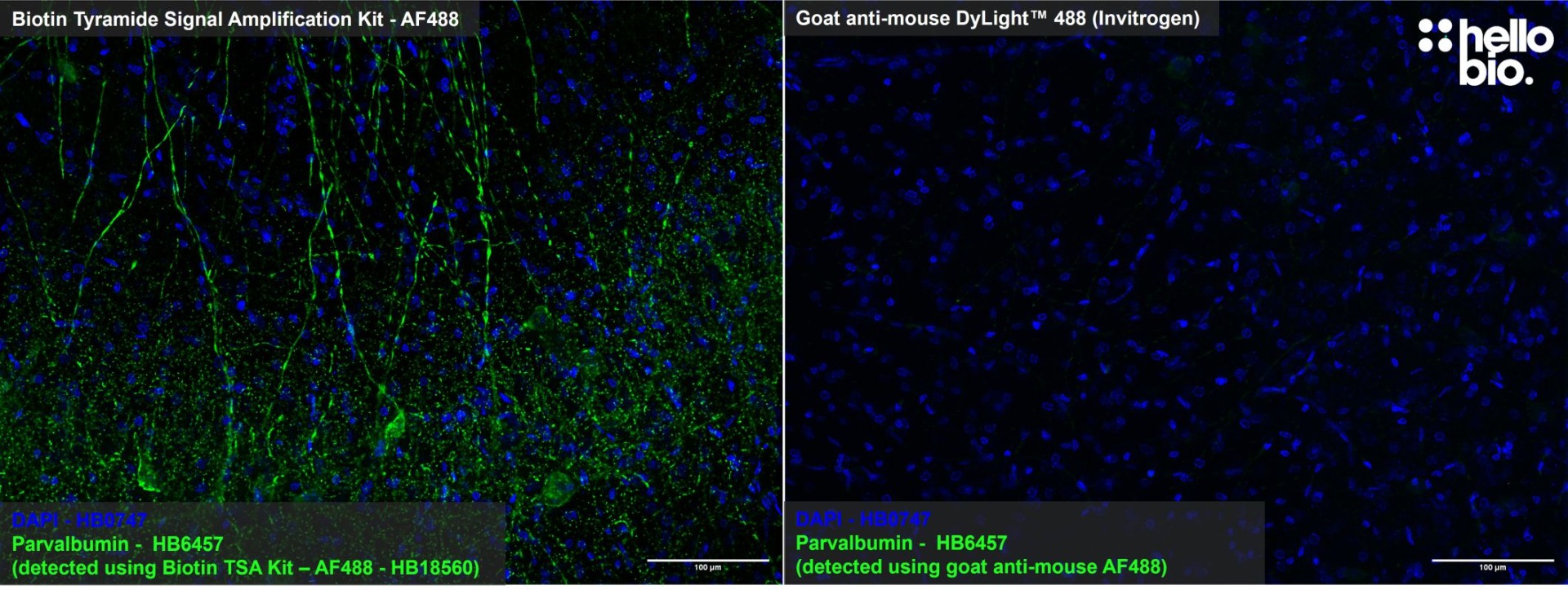Figure 1: Biotin Tyramide Signal Amplification enhances parvalbumin staining compared to fluorescent secondary antibody in the rat hippocampus.